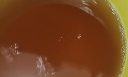 Pese a crisis de agua sucia, SSJ descarta incremento atípico de infecciones