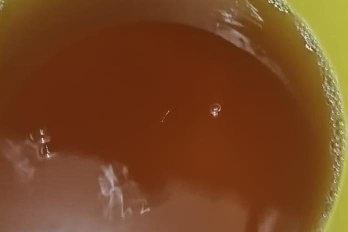 Pese a crisis de agua sucia, SSJ descarta incremento atípico de infecciones